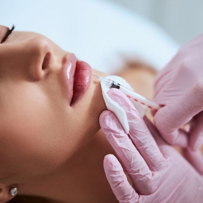 Lip Fillers